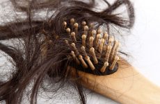 How To Deal With Postpartum Hair Loss